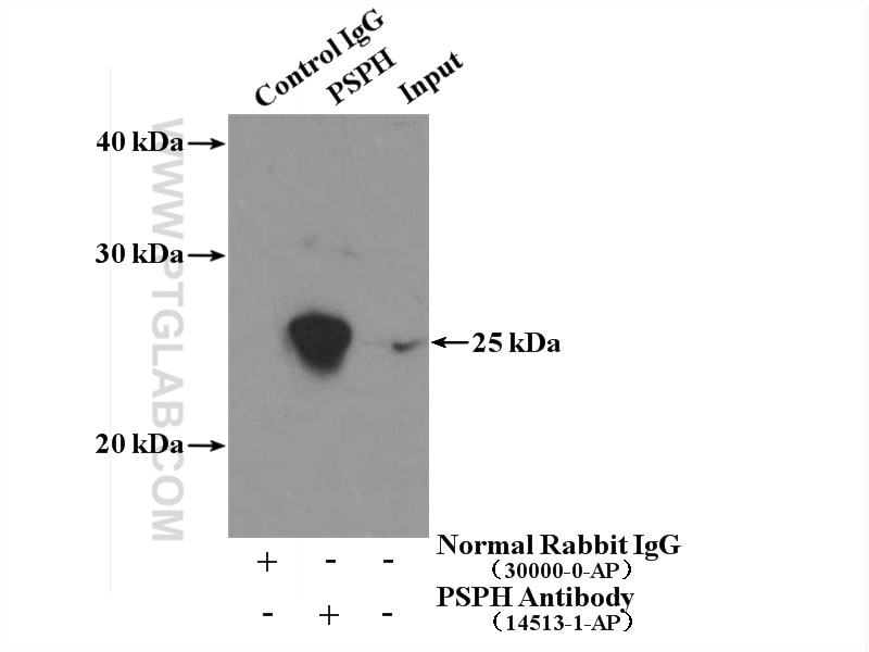 Immunoprecipitation (IP) experiment of HL-60 cells using PSPH Polyclonal antibody (14513-1-AP)
