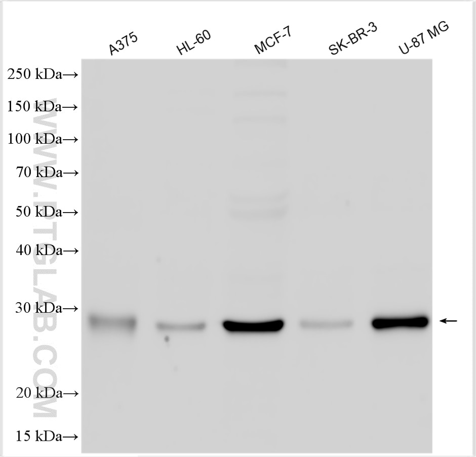 Western Blot (WB) analysis of various lysates using PSPH Polyclonal antibody (14513-1-AP)