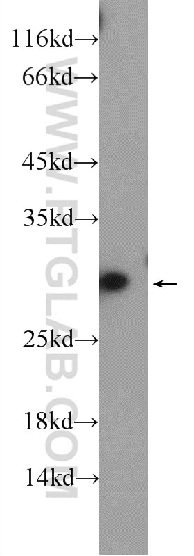 Western Blot (WB) analysis of rat liver tissue using PSPH Polyclonal antibody (14513-1-AP)