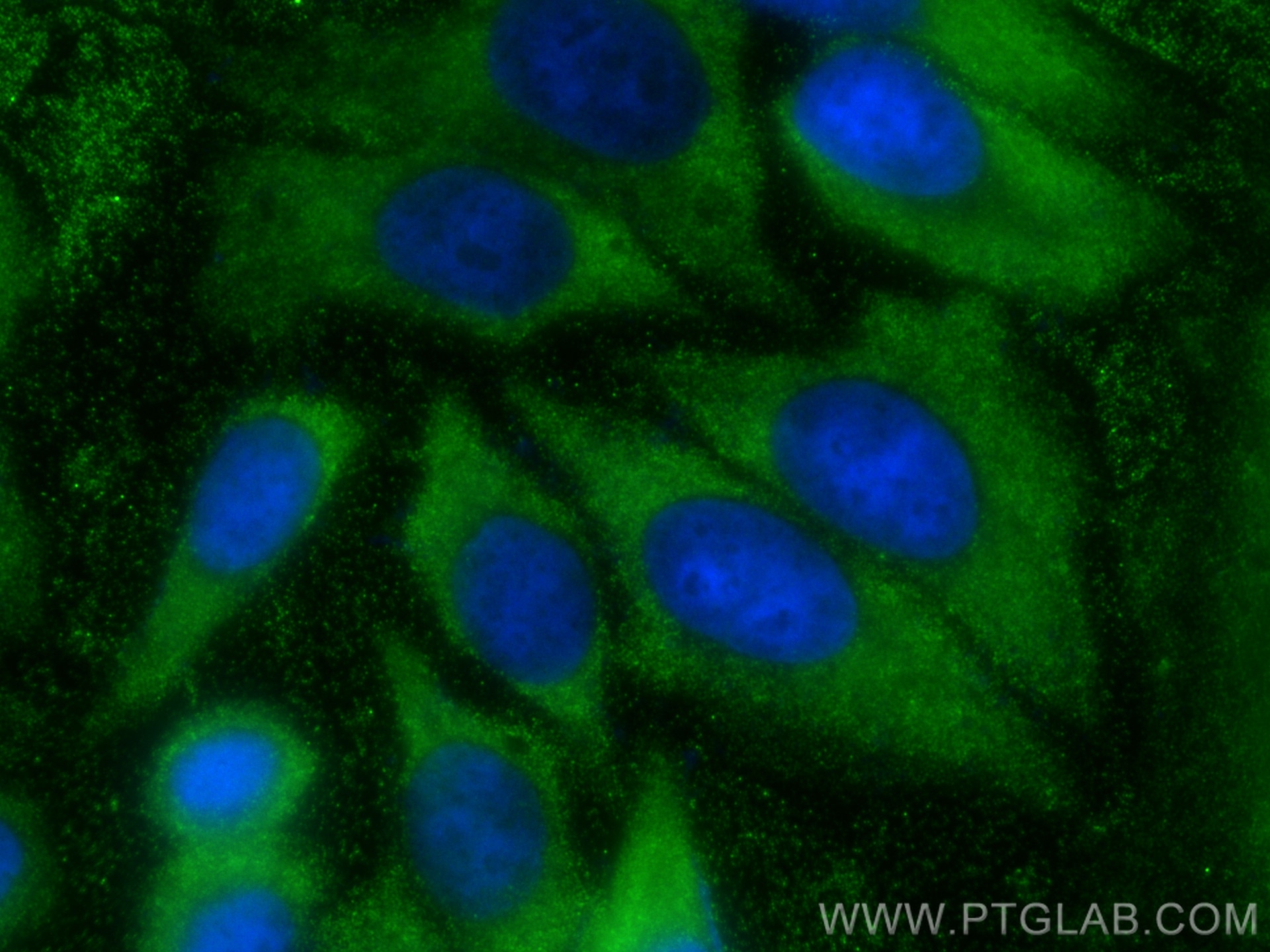 Immunofluorescence (IF) / fluorescent staining of HepG2 cells using PSPH Monoclonal antibody (68500-1-Ig)