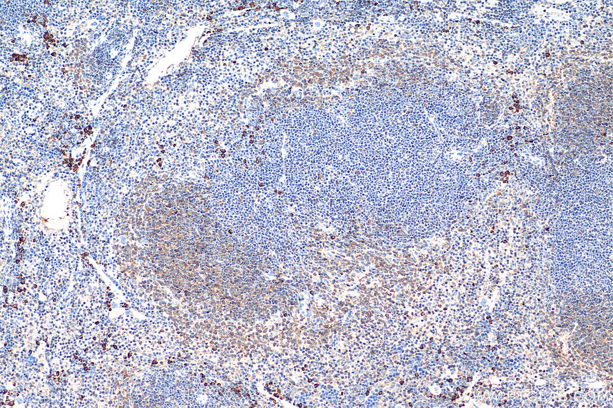 Immunohistochemistry (IHC) staining of mouse spleen tissue using PSPH Monoclonal antibody (68500-1-Ig)