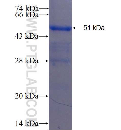 PSPH fusion protein Ag5972 SDS-PAGE