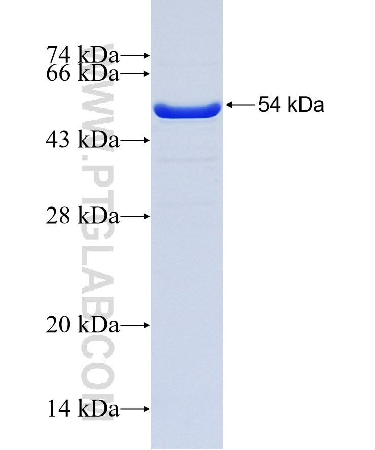 PSPH fusion protein Ag5972 SDS-PAGE