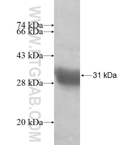 PSPH fusion protein Ag6070 SDS-PAGE
