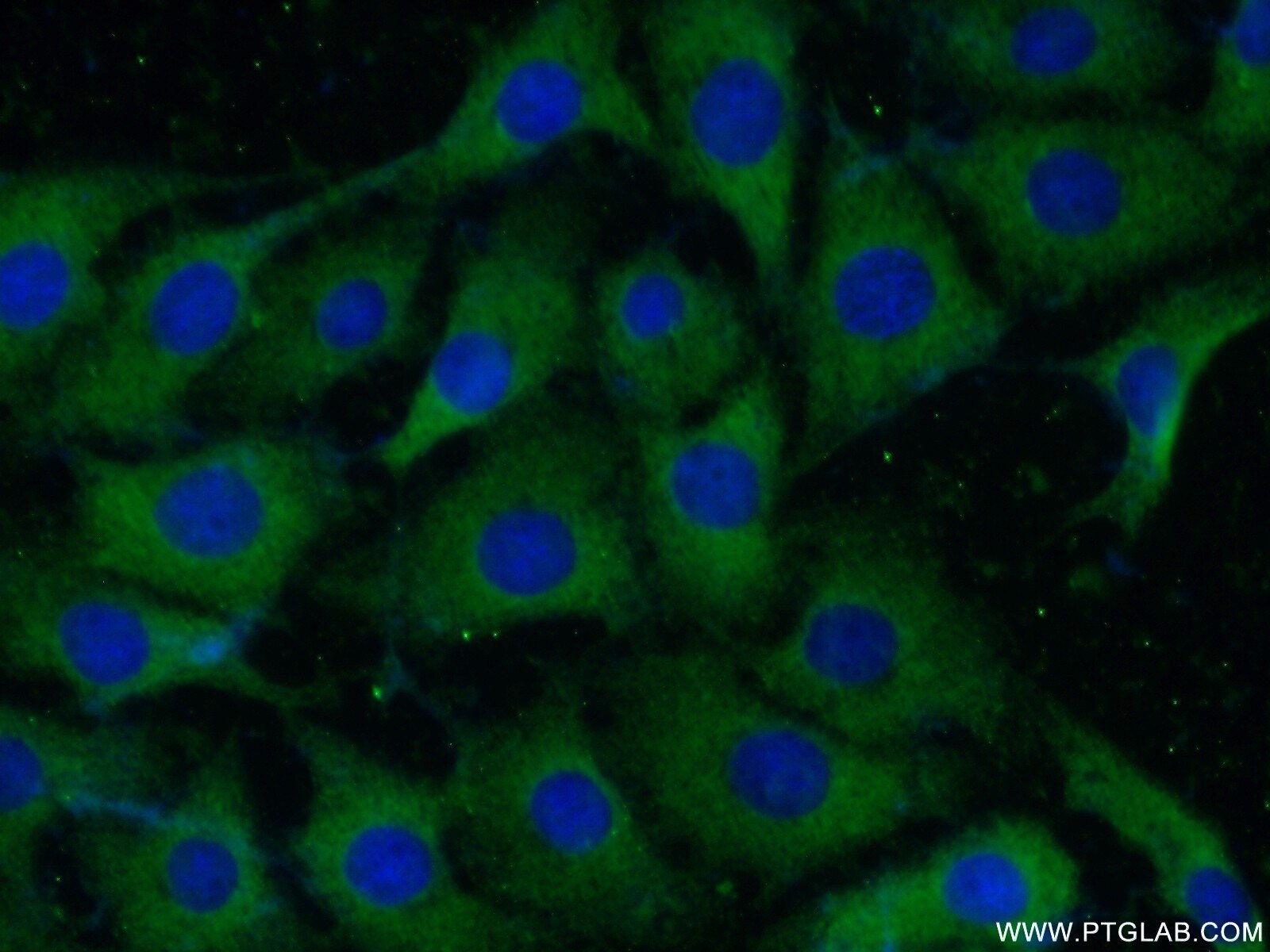 Immunofluorescence (IF) / fluorescent staining of SH-SY5Y cells using persephin-Specific Polyclonal antibody (19713-1-AP)