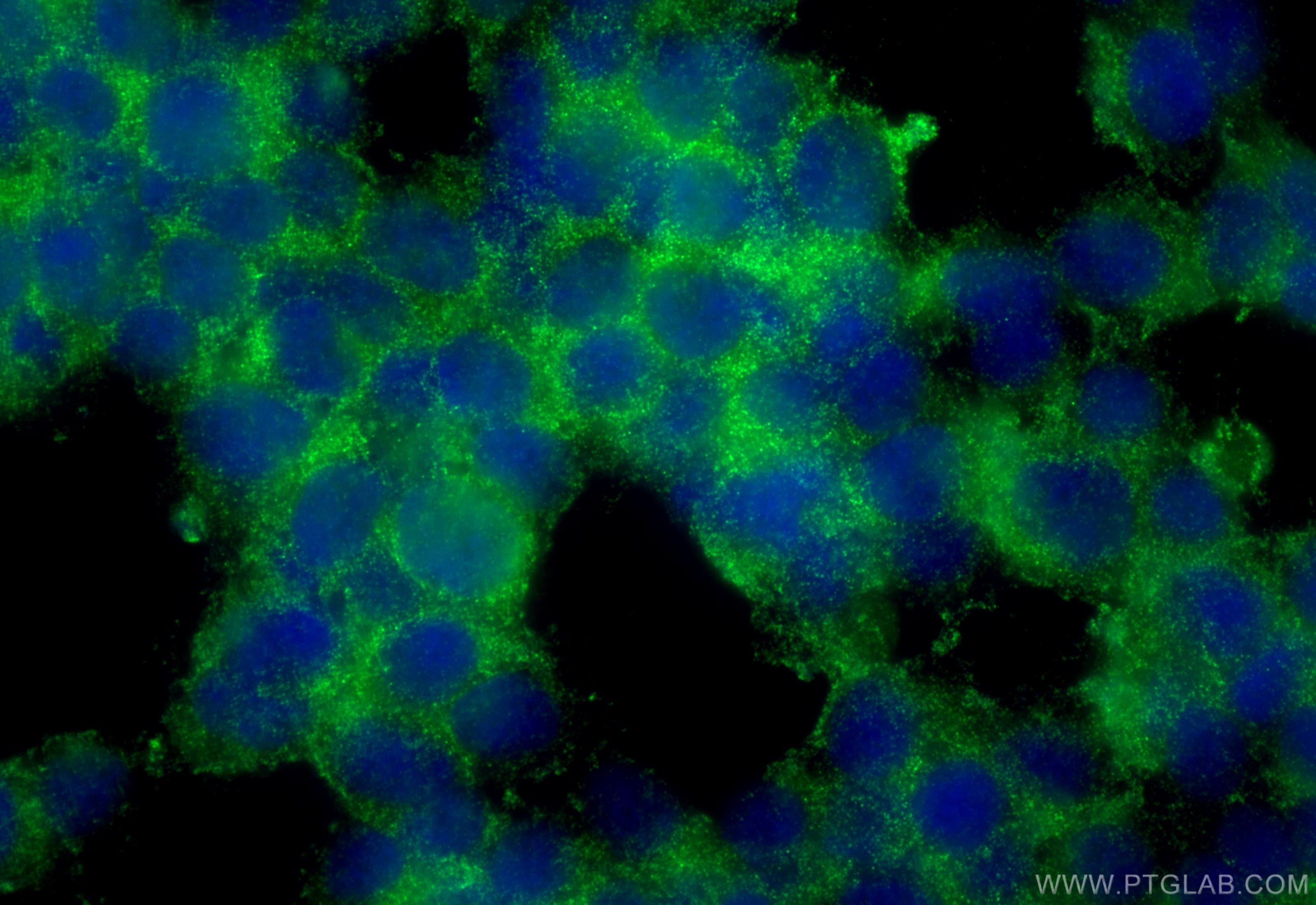Immunofluorescence (IF) / fluorescent staining of SH-SY5Y cells using persephin-Specific Polyclonal antibody (19713-1-AP)
