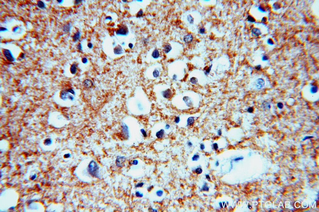 Immunohistochemistry (IHC) staining of human brain tissue using persephin-Specific Polyclonal antibody (19713-1-AP)