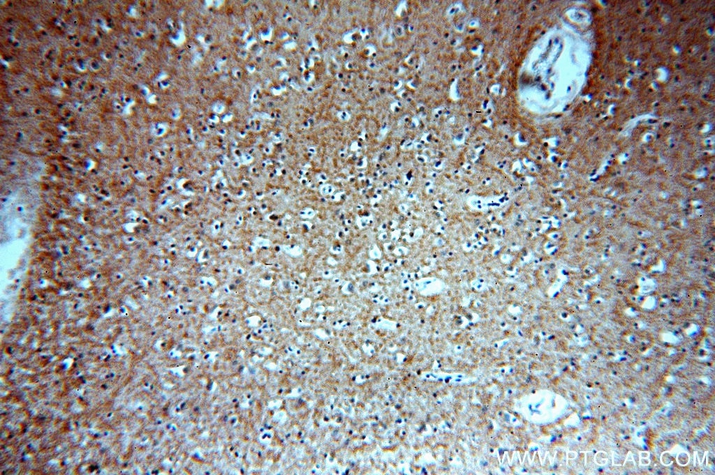 Immunohistochemistry (IHC) staining of human brain tissue using persephin-Specific Polyclonal antibody (19713-1-AP)