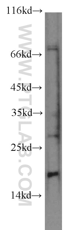 Western Blot (WB) analysis of SH-SY5Y cells using persephin-Specific Polyclonal antibody (19713-1-AP)