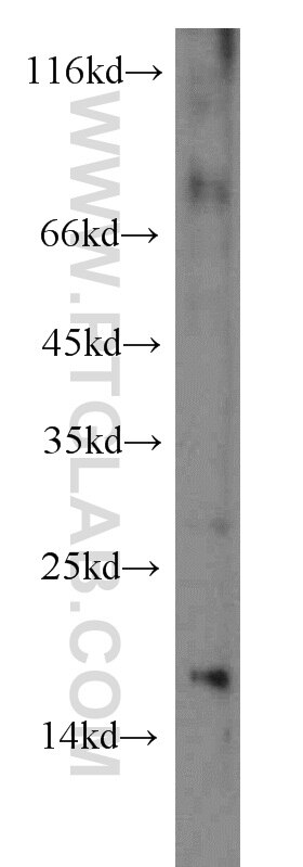 Western Blot (WB) analysis of HepG2 cells using persephin-Specific Polyclonal antibody (19713-1-AP)