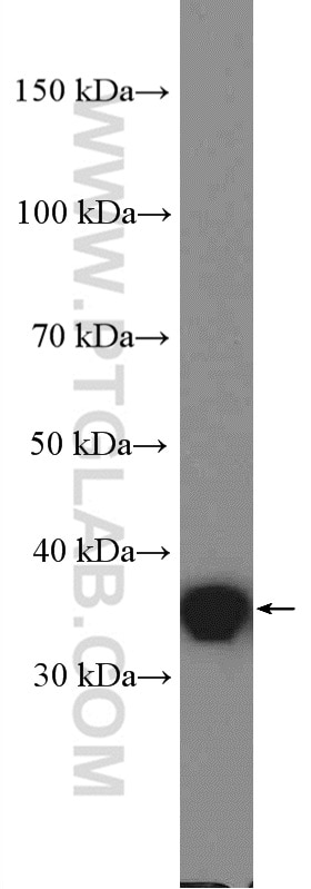 Western Blot (WB) analysis of A431 cells using PSRC1 Polyclonal antibody (27130-1-AP)