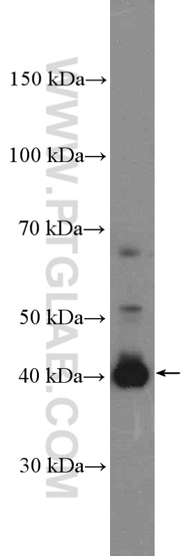 Western Blot (WB) analysis of HEK-293T cells using PSRC1 Polyclonal antibody (27130-1-AP)