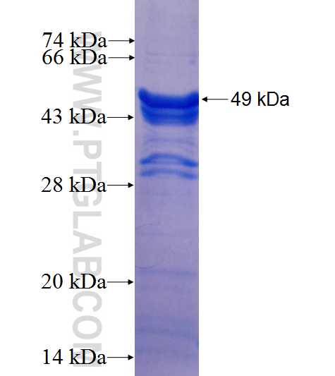 PSRC1 fusion protein Ag26039 SDS-PAGE