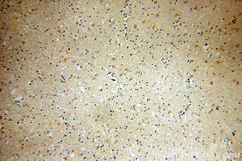 Immunohistochemistry (IHC) staining of human brain tissue using PSTPIP1 Polyclonal antibody (11951-1-AP)