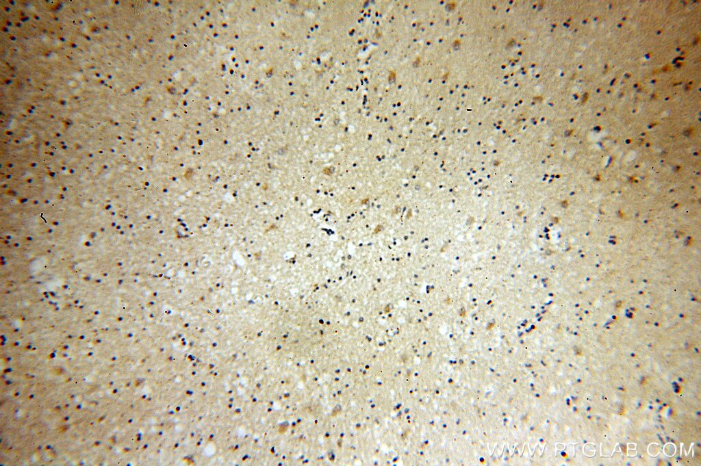 IHC staining of human brain using 11951-1-AP