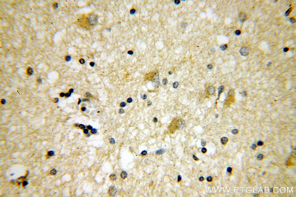 IHC staining of human brain using 11951-1-AP