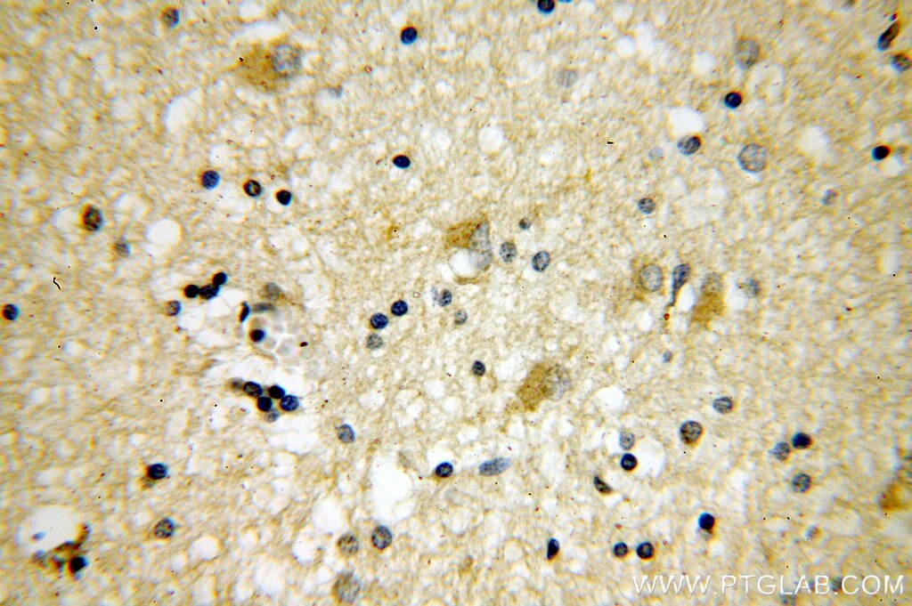 Immunohistochemistry (IHC) staining of human brain tissue using PSTPIP1 Polyclonal antibody (11951-1-AP)