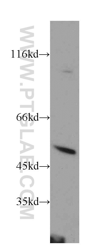 Western Blot (WB) analysis of mouse thymus tissue using PSTPIP1 Polyclonal antibody (11951-1-AP)