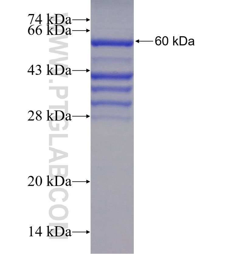 PSTPIP2 fusion protein Ag4293 SDS-PAGE