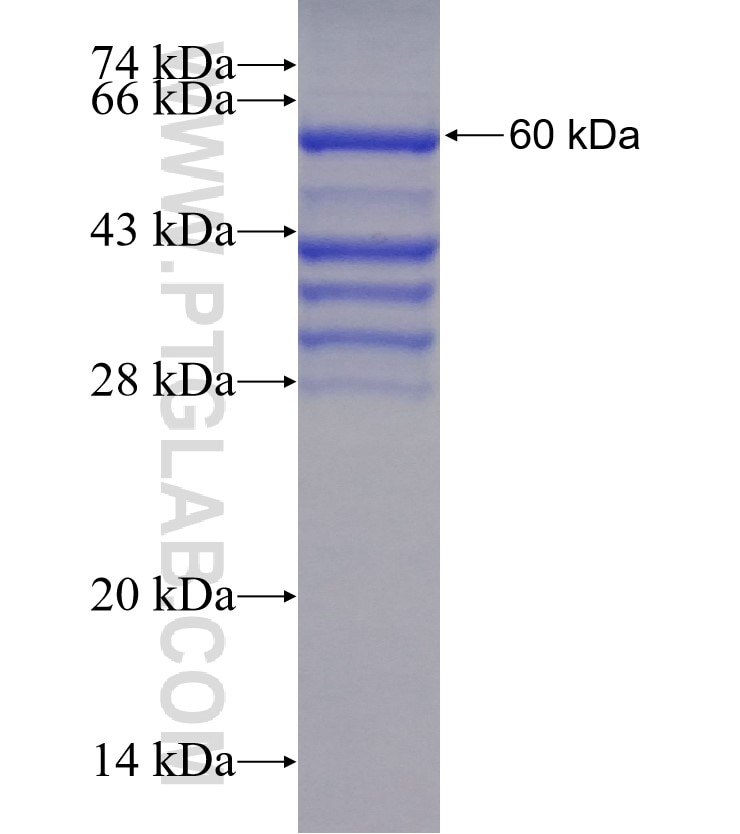 PSTPIP2 fusion protein Ag4293 SDS-PAGE