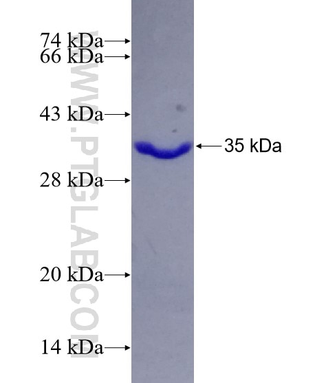 PSTPIP2 fusion protein Ag4364 SDS-PAGE