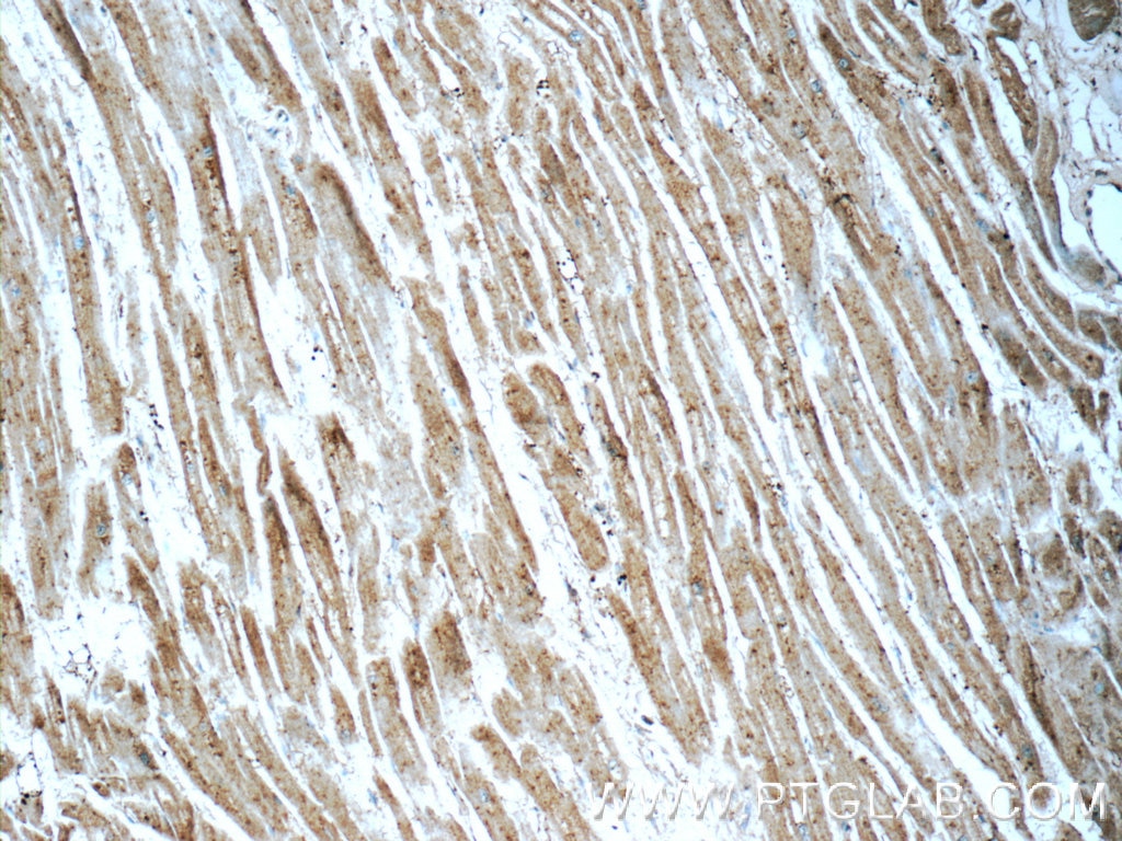 Immunohistochemistry (IHC) staining of human heart tissue using PTAFR Polyclonal antibody (20921-1-AP)