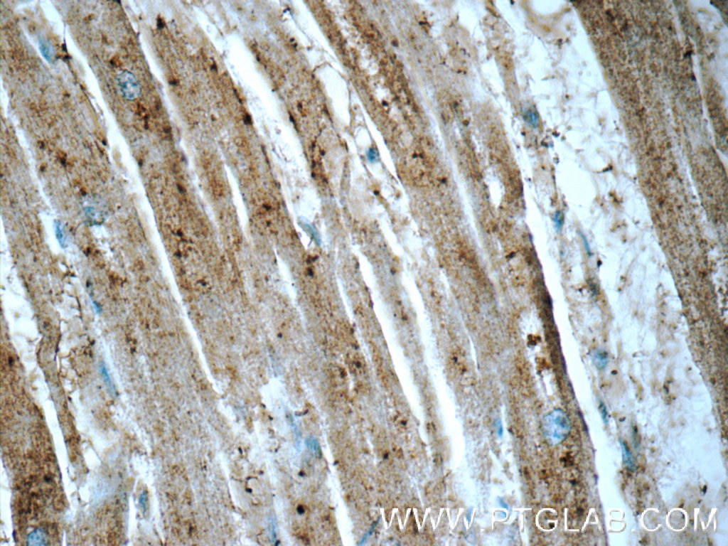 IHC staining of human heart using 20921-1-AP