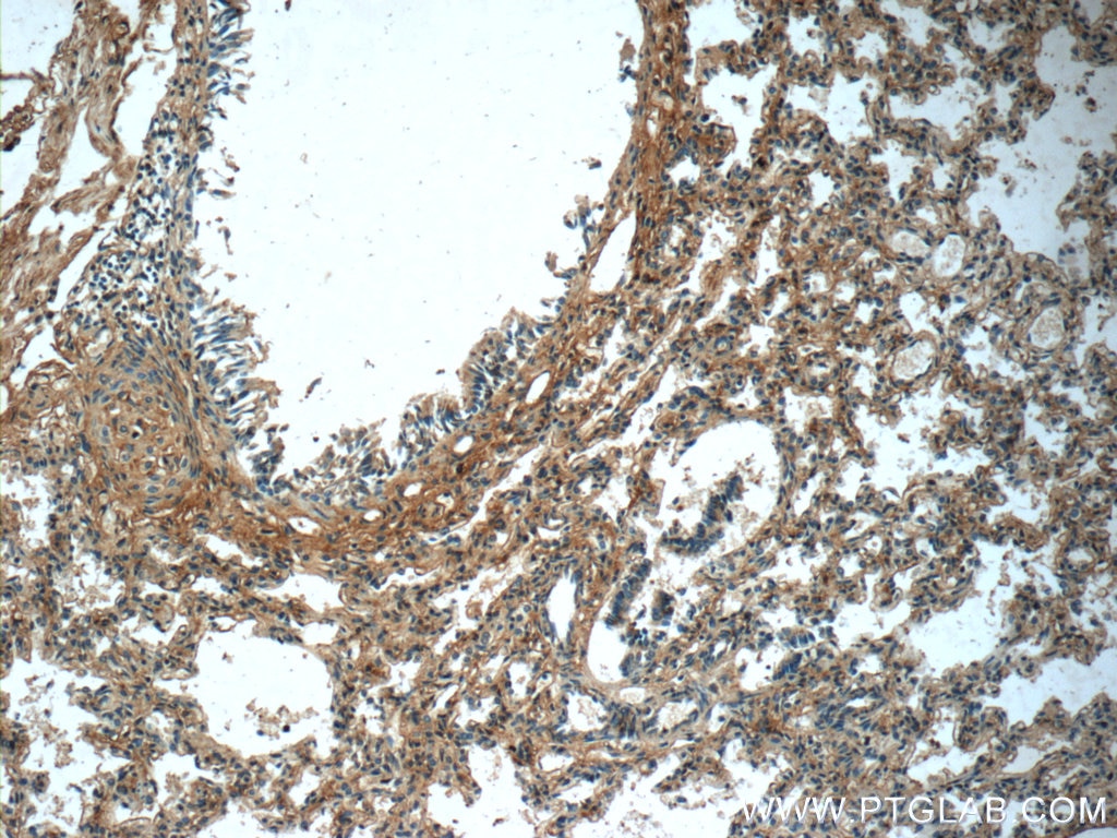 IHC staining of human lung using 20921-1-AP