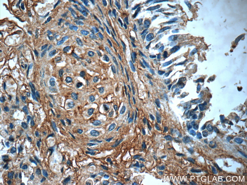 Immunohistochemistry (IHC) staining of human lung tissue using PTAFR Polyclonal antibody (20921-1-AP)