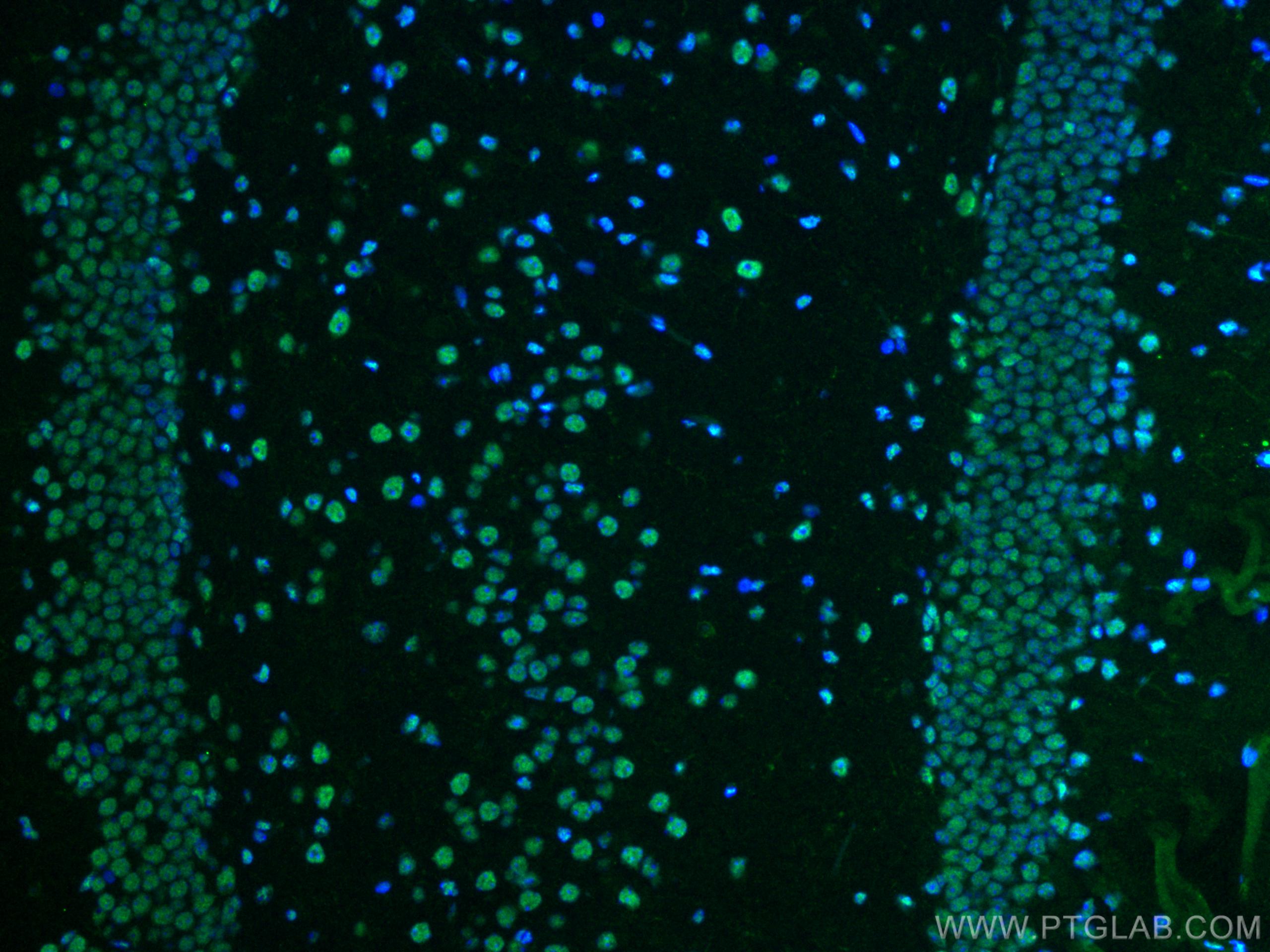 IF Staining of mouse brain using 12582-1-AP