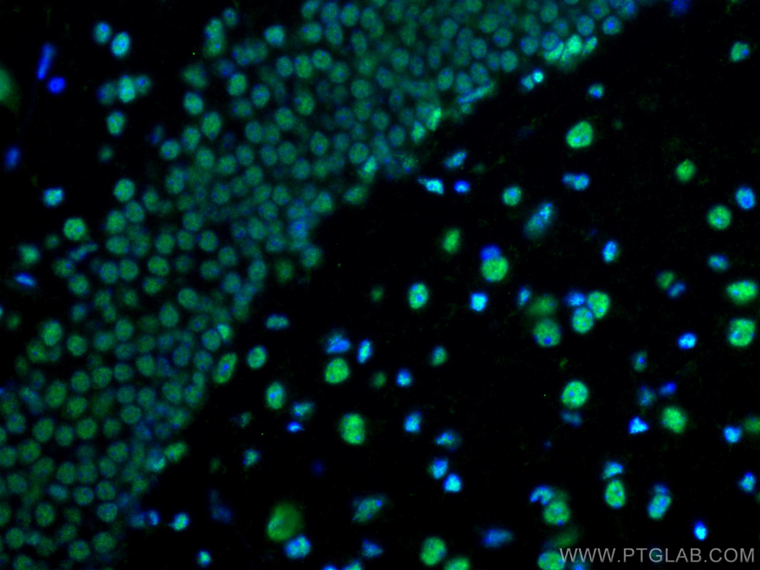 Immunofluorescence (IF) / fluorescent staining of mouse brain tissue using PTBP1 Polyclonal antibody (12582-1-AP)