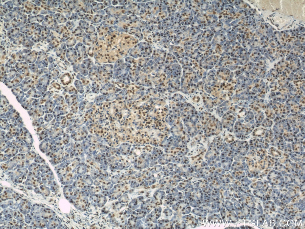 Immunohistochemistry (IHC) staining of human pancreas tissue using PTBP1 Polyclonal antibody (12582-1-AP)