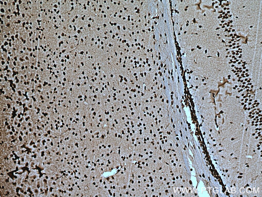 Immunohistochemistry (IHC) staining of mouse brain tissue using PTBP1 Polyclonal antibody (12582-1-AP)