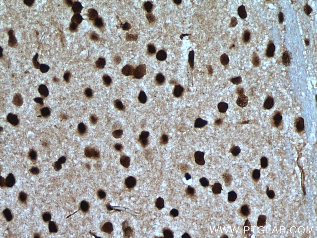 Immunohistochemistry (IHC) staining of mouse brain tissue using PTBP1 Polyclonal antibody (12582-1-AP)
