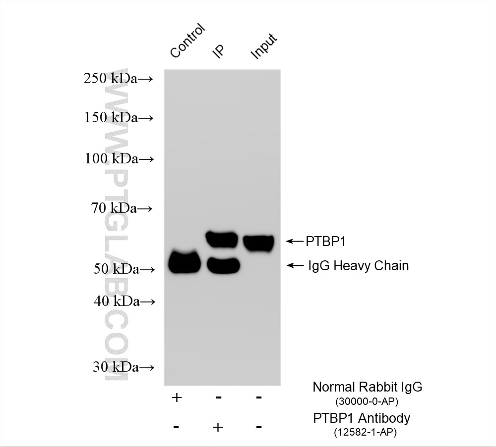 Immunoprecipitation (IP) experiment of Jurkat cells using PTBP1 Polyclonal antibody (12582-1-AP)