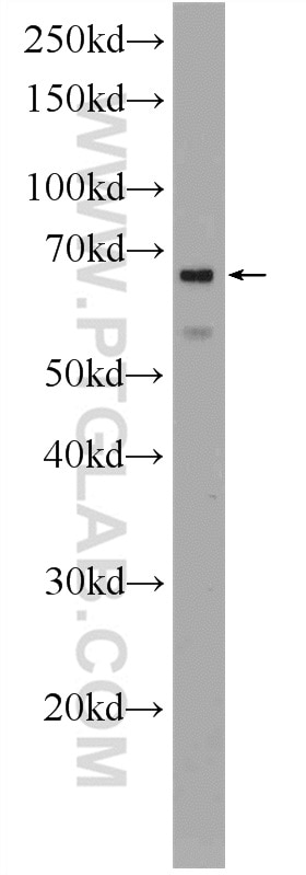 Western Blot (WB) analysis of rat heart tissue using PTBP1 Polyclonal antibody (12582-1-AP)