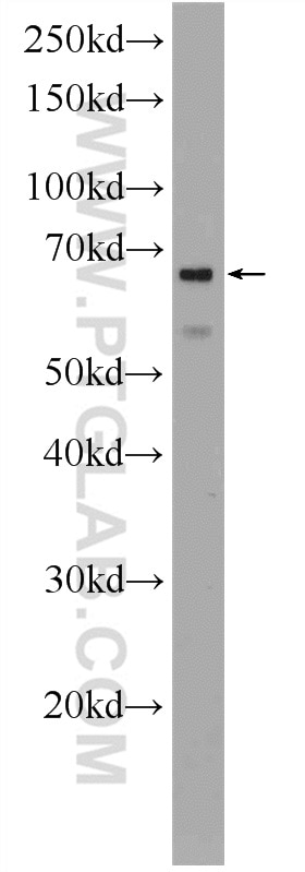 WB analysis of rat heart using 12582-1-AP