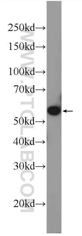 WB analysis of mouse lung using 12582-1-AP