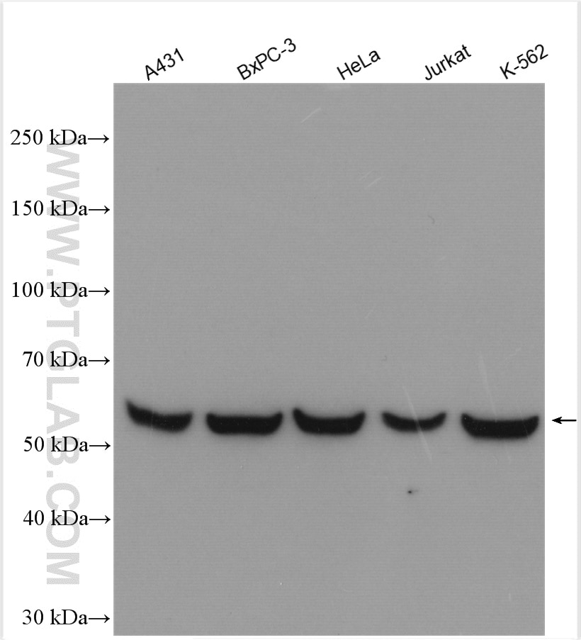 Western Blot (WB) analysis of various lysates using PTBP1 Polyclonal antibody (12582-1-AP)