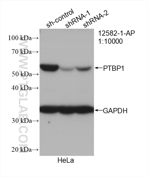 Western Blot (WB) analysis of HeLa cells using PTBP1 Polyclonal antibody (12582-1-AP)