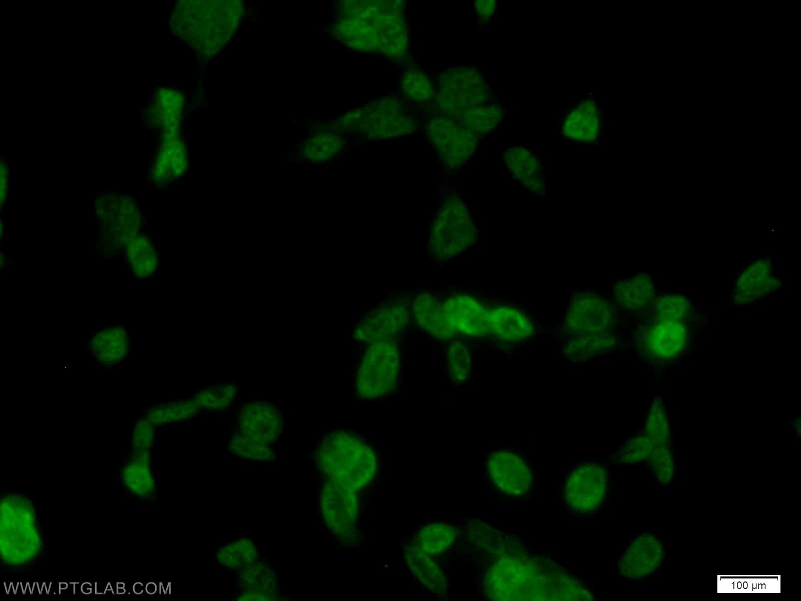 Immunofluorescence (IF) / fluorescent staining of HEK-293 cells using PTBP1 Polyclonal antibody (55181-1-AP)