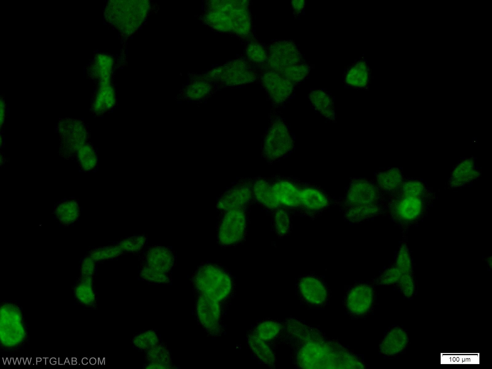 IF Staining of HEK-293 using 55181-1-AP