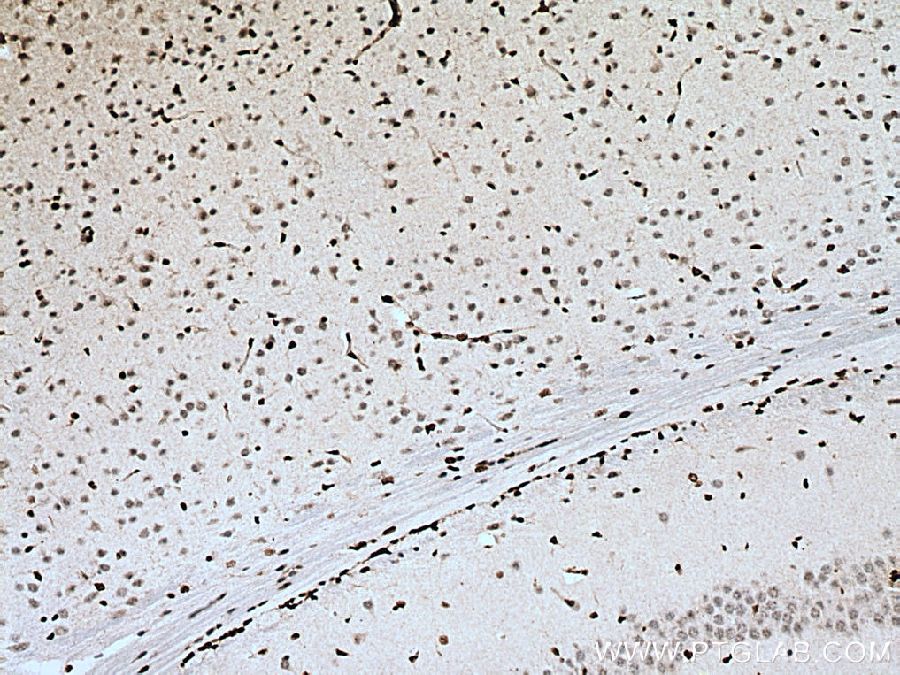 Immunohistochemistry (IHC) staining of mouse brain tissue using PTBP1 Polyclonal antibody (55181-1-AP)