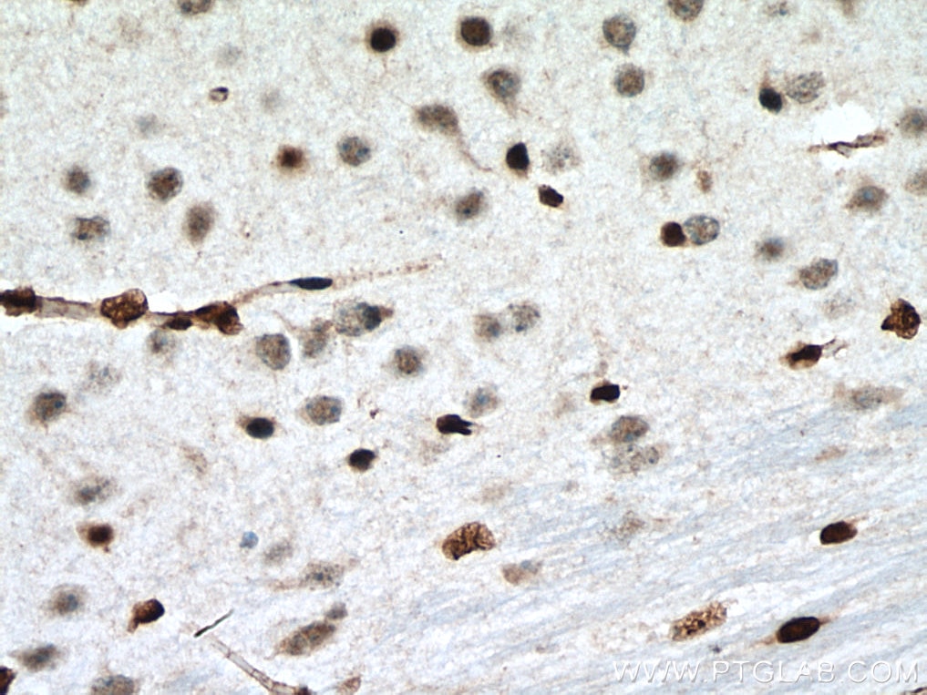 Immunohistochemistry (IHC) staining of mouse brain tissue using PTBP1 Polyclonal antibody (55181-1-AP)