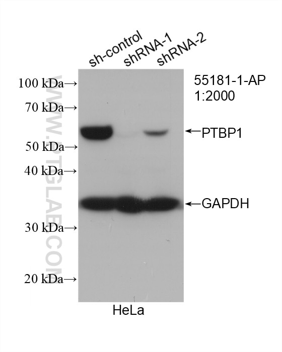 Western Blot (WB) analysis of HeLa cells using PTBP1 Polyclonal antibody (55181-1-AP)