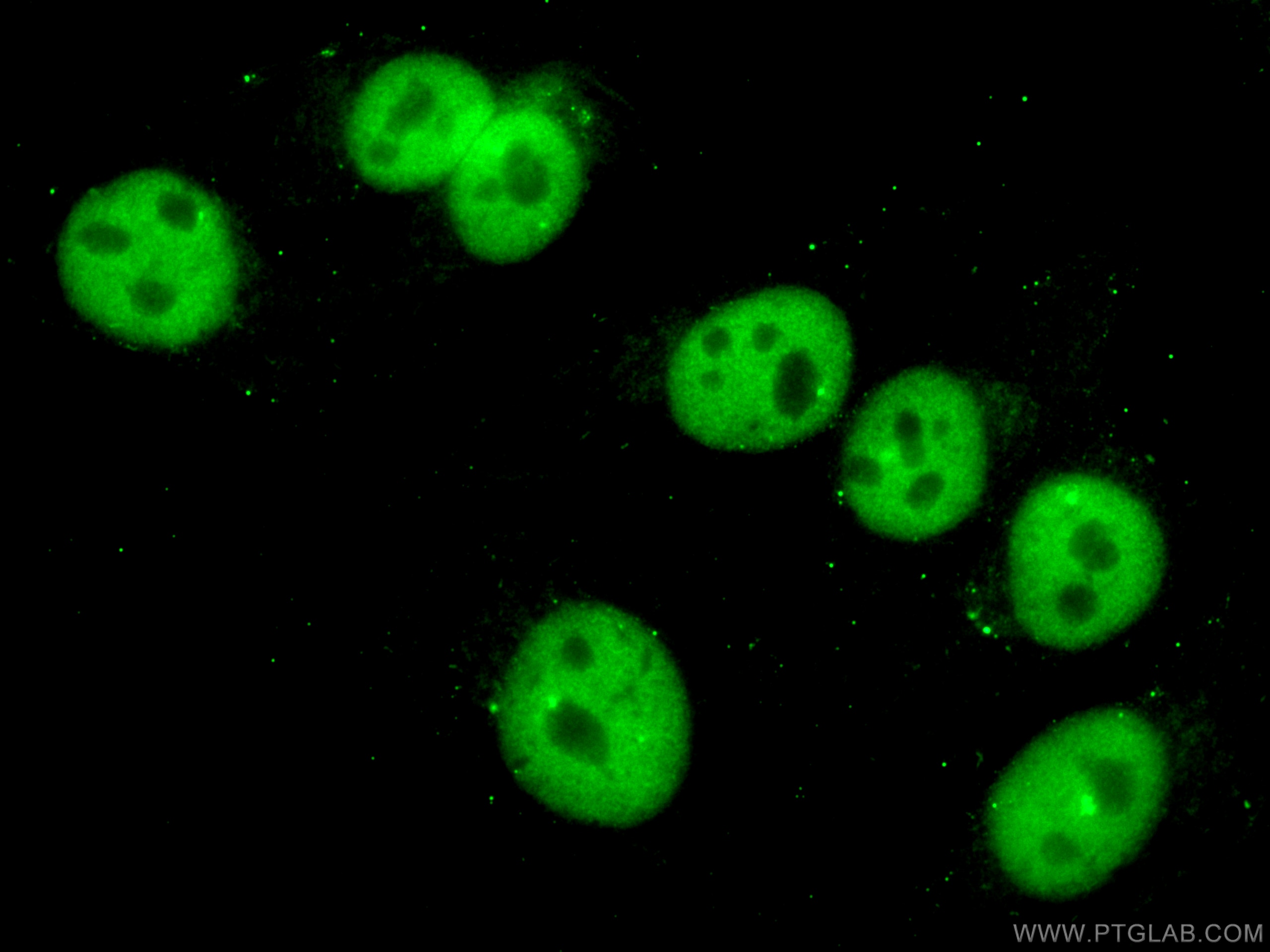 Immunofluorescence (IF) / fluorescent staining of A375 cells using PTBP1 Monoclonal antibody (67462-1-Ig)