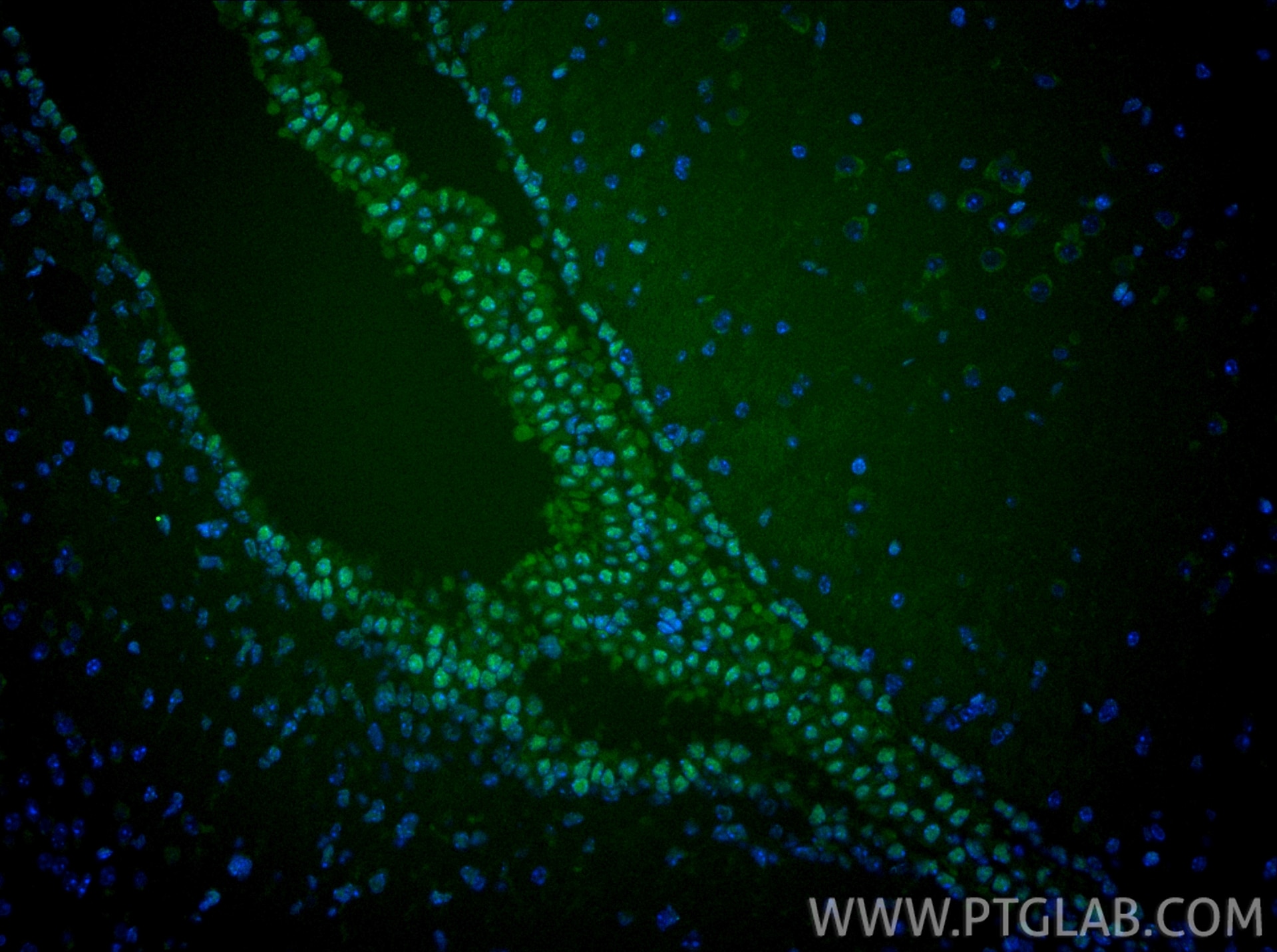 IF Staining of mouse brain using CL488-67462 Immunofluorescence (IF) / fluorescent staining of mouse brain tissue using CoraLite® Plus 488-conjugated PTBP1 Monoclonal ant (CL488-67462)