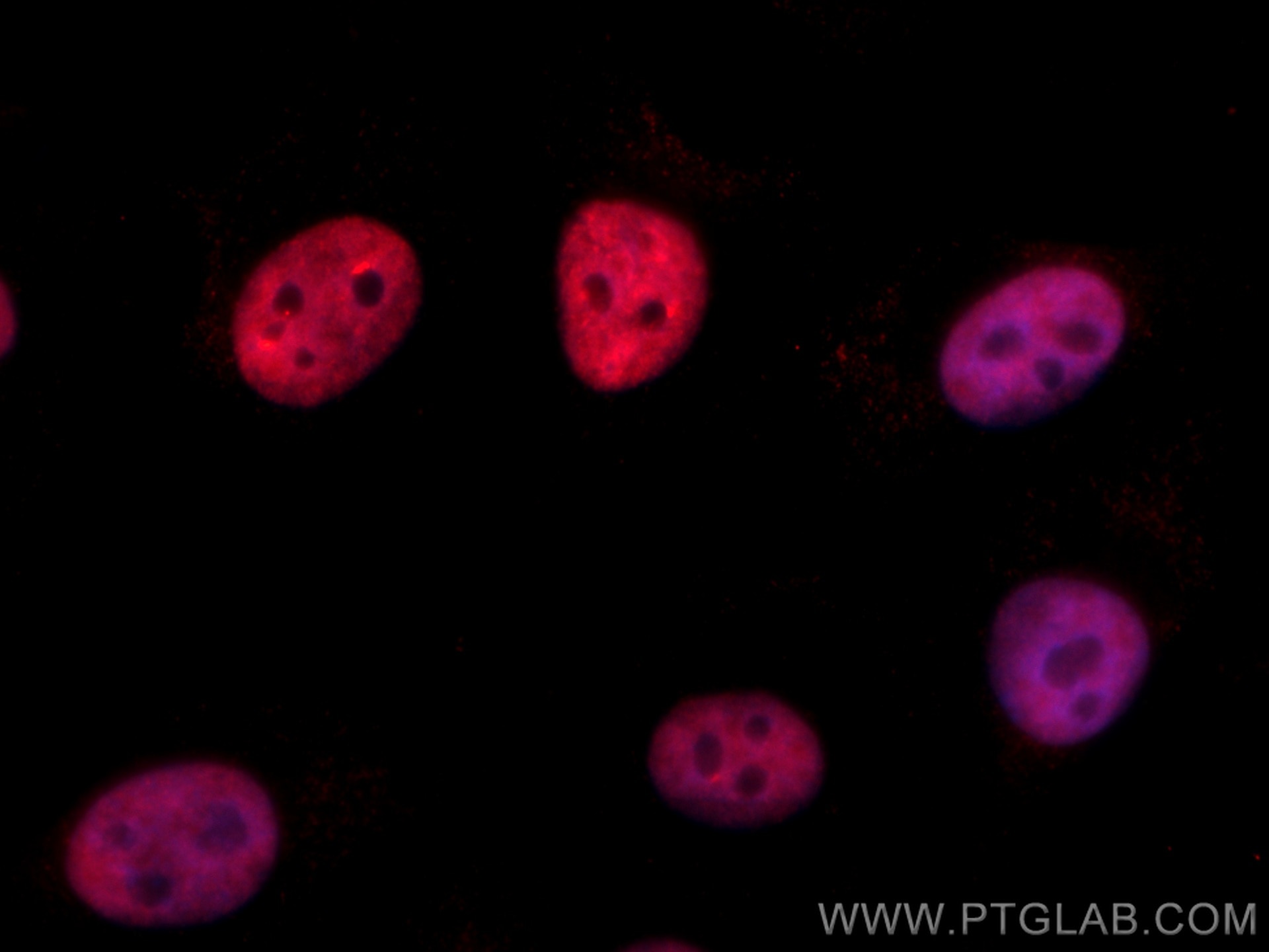 Immunofluorescence (IF) / fluorescent staining of A375 cells using CoraLite®594-conjugated PTBP1 Monoclonal antibody (CL594-67462)