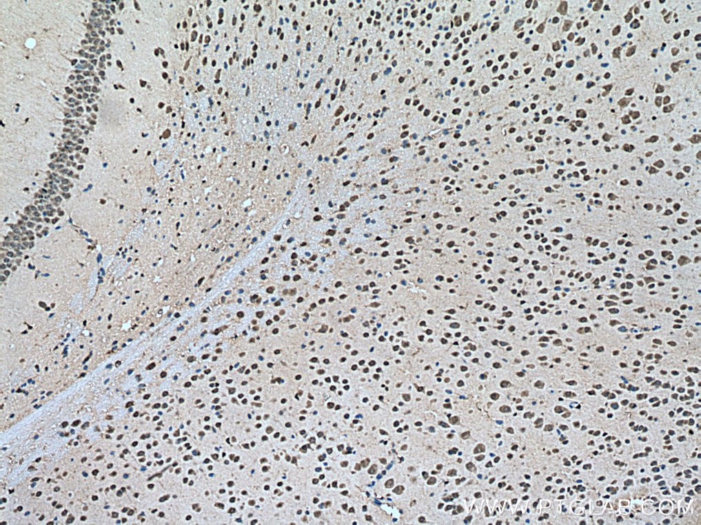 Immunohistochemistry (IHC) staining of mouse brain tissue using PTBP2 Polyclonal antibody (55186-1-AP)