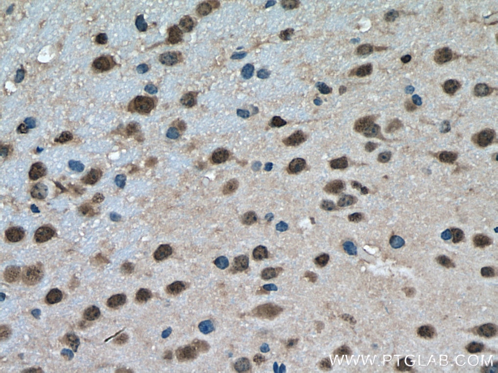 Immunohistochemistry (IHC) staining of mouse brain tissue using PTBP2 Polyclonal antibody (55186-1-AP)